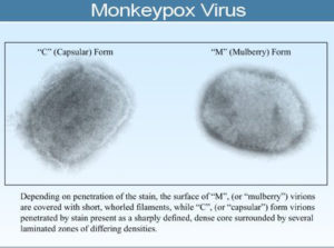 Monkeypox Facts, Symptoms, Causes & Treatment