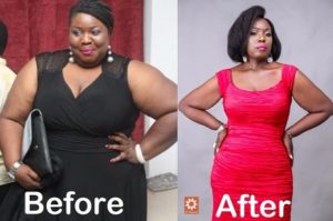 Lepacious Bose Before and After Pictures