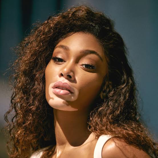 Winnie Harlow Biography: Real Name, Age, Height, Parents, Siblings, Husband, Net Worth